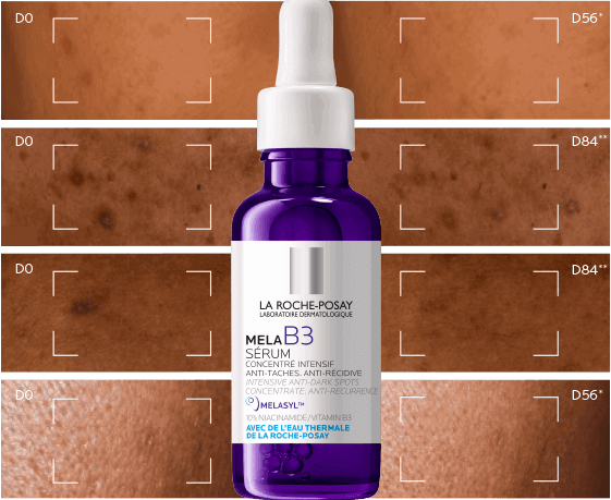 Serum przed i po